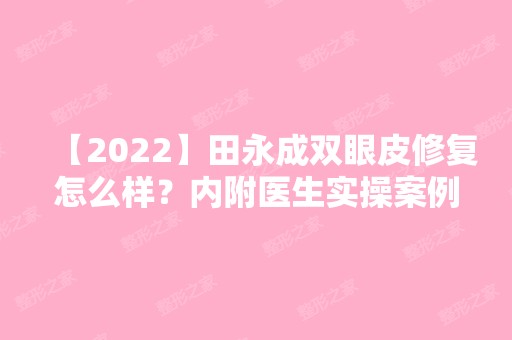 【2024】田永成双眼皮修复怎么样？内附医生实操案例分享