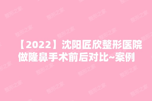 【2024】沈阳匠欣整形医院做隆鼻手术前后对比~案例