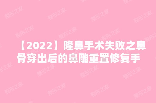 【2024】隆鼻手术失败之鼻骨穿出后的鼻雕重置修复手术怎么样？附价格表参考