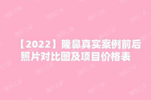 【2024】隆鼻真实案例前后照片对比图及项目价格表