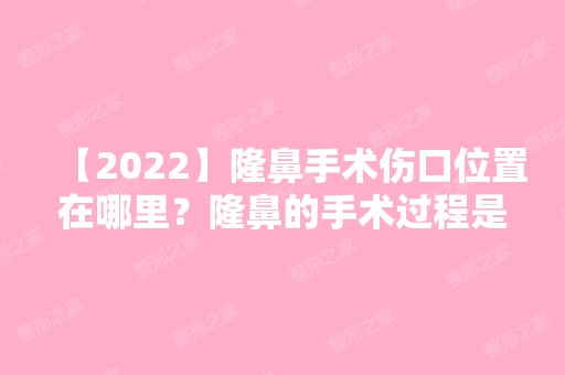 【2024】隆鼻手术伤口位置在哪里？隆鼻的手术过程是怎么样的？