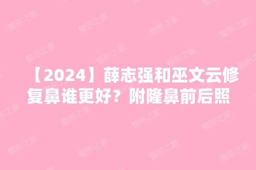 【2024】薛志强和巫文云修复鼻谁更好？附隆鼻前后照片对比+价格表推荐