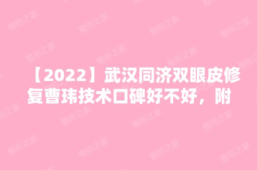 【2024】武汉同济双眼皮修复曹玮技术口碑好不好，附价格表及优秀案例