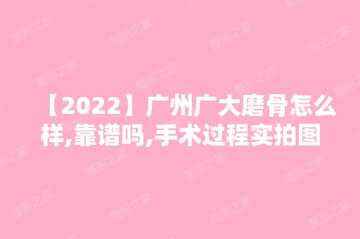 【2024】广州广大磨骨怎么样,靠谱吗,手术过程实拍图来袭！