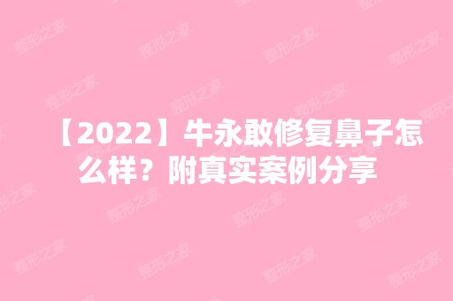 【2024】牛永敢修复鼻子怎么样？附真实案例分享