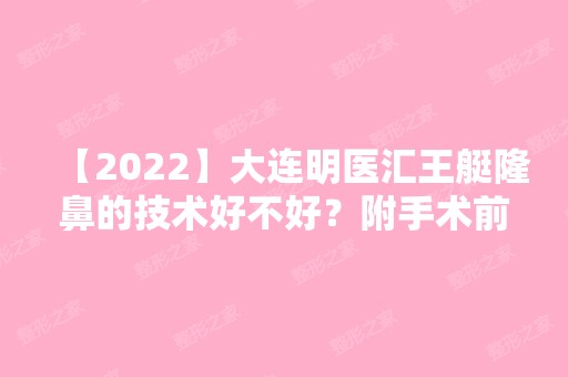 【2024】大连明医汇王艇隆鼻的技术好不好？附手术前后对比分享