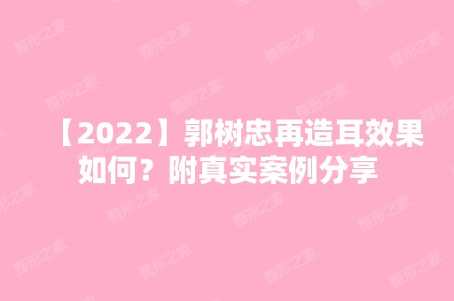 【2024】郭树忠再造耳效果如何？附真实案例分享