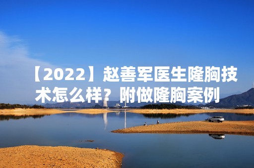 【2024】医生隆胸技术怎么样？附做隆胸案例