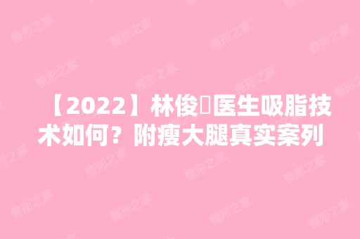 【2024】林俊湧医生吸脂技术如何？附瘦大腿真实案列分享