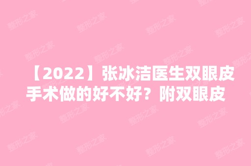 【2024】张冰洁医生双眼皮手术做的好不好？附双眼皮手术案例分享