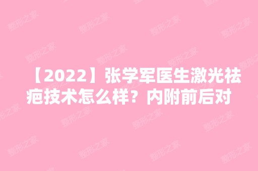 【2024】张学军医生激光祛疤技术怎么样？内附前后对比