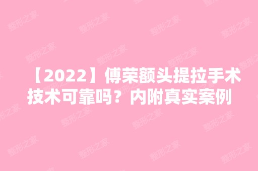 【2024】傅荣额头提拉手术技术可靠吗？内附真实案例~