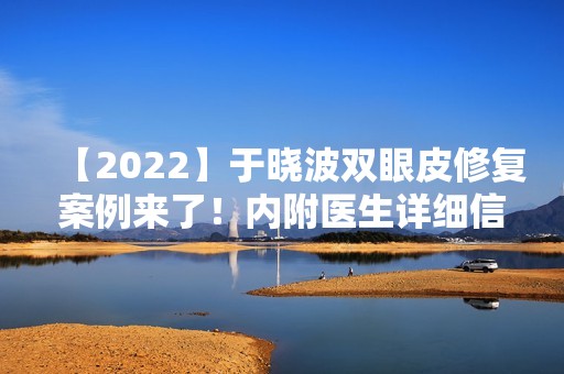 【2024】于晓波双眼皮修复案例来了！内附医生详细信息分享