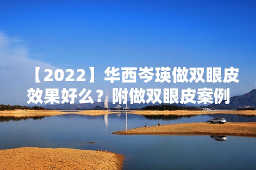 【2024】华西岑瑛做双眼皮效果好么？附做双眼皮案例