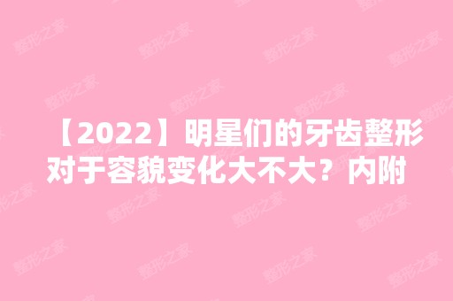 【2024】明星们的牙齿整形对于容貌变化大不大？内附案例