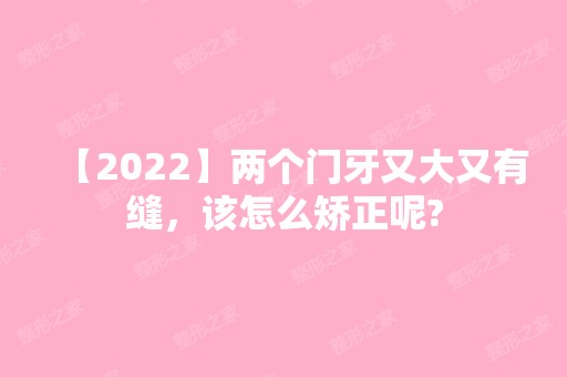 【2024】两个门牙又大又有缝，该怎么矫正呢?