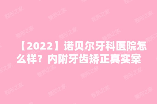 【2024】诺贝尔牙科医院怎么样？内附牙齿矫正真实案例