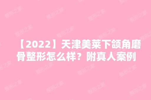 【2024】天津美莱下颌角磨骨整形怎么样？附真人案例分享带图