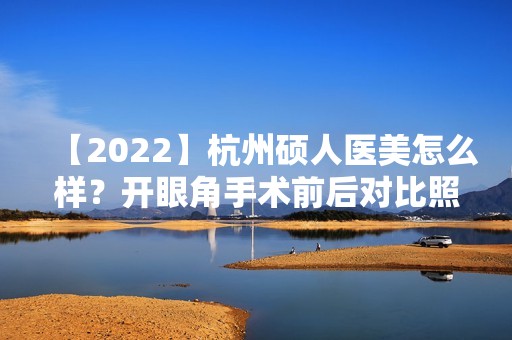 【2024】杭州硕人医美怎么样？开眼角手术前后对比照来袭