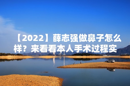 【2024】薛志强做鼻子怎么样？来看看本人手术过程实拍图就知道啦！附价格表