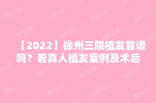 【2024】徐州三院植发靠谱吗？看真人植发案例及术后恢复图