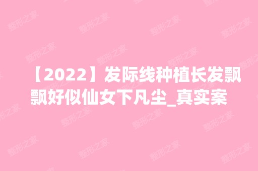 【2024】发际线种植长发飘飘好似仙女下凡尘_真实案例反馈_新价格表查询