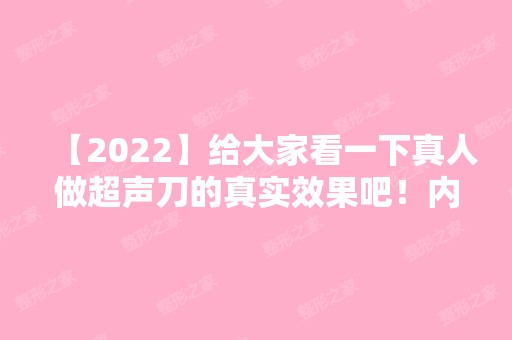 【2024】给大家看一下真人做超声刀的真实效果吧！内有实拍对比图及价格表哦