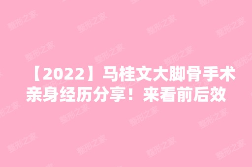 【2024】马桂文大脚骨手术亲身经历分享！来看前后效果好不好吧