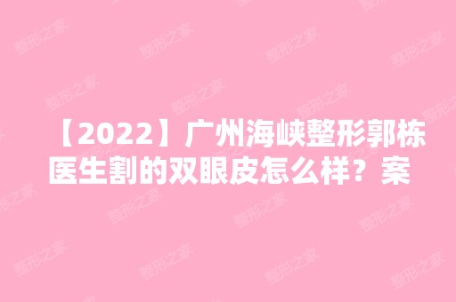 【2024】广州海峡整形郭栋医生割的双眼皮怎么样？案例分享内附前后对比~