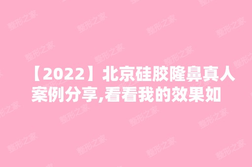 【2024】北京硅胶隆鼻真人案例分享,看看我的效果如何,内附前后对比效果图