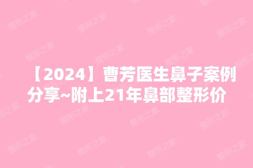 【2024】曹芳医生鼻子案例分享~附上24年鼻部整形价格表