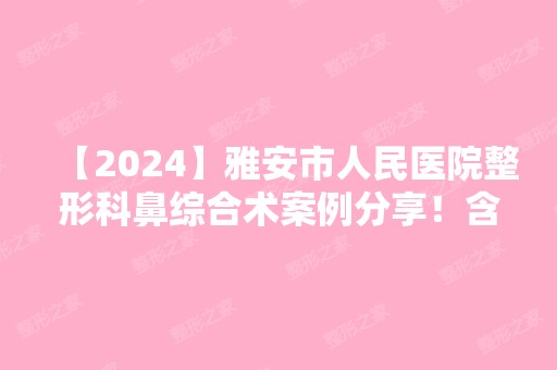 【2024】雅安市人民医院整形科鼻综合术案例分享！含全新价格表价目表详情