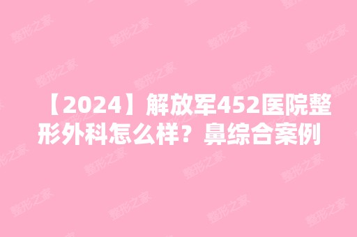 【2024】解放军452医院整形外科怎么样？鼻综合案例效果对比及价格价目表展示