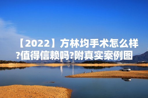 【2024】方林均手术怎么样?值得信赖吗?附真实案例图