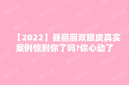 【2024】聂丽丽双眼皮真实案例惊到你了吗?你心动了吗?附真实案例图