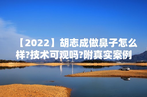 【2024】胡志成做鼻子怎么样?技术可观吗?附真实案例图