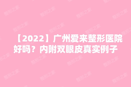 【2024】广州爱来整形医院好吗？内附双眼皮真实例子分享~快来看看吧