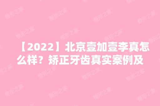 【2024】北京壹加壹李真怎么样？矫正牙齿真实案例及医生介绍