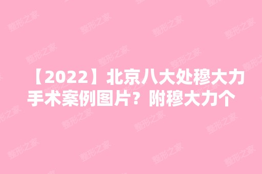 【2024】北京八大处穆大力手术案例图片？附穆大力个人介绍