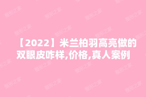 【2024】米兰柏羽高亮做的双眼皮咋样,价格,真人案例分享