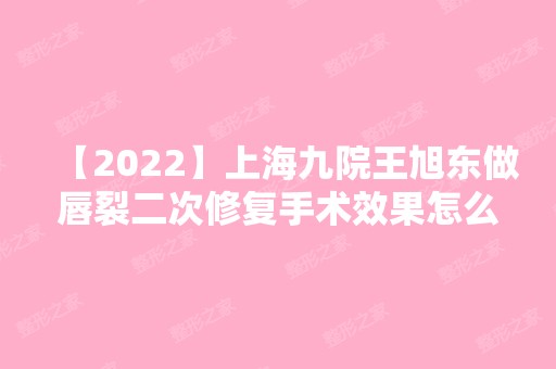 【2024】上海九院王旭东做唇裂二次修复手术效果怎么样?坐诊时间,案例效果图分享