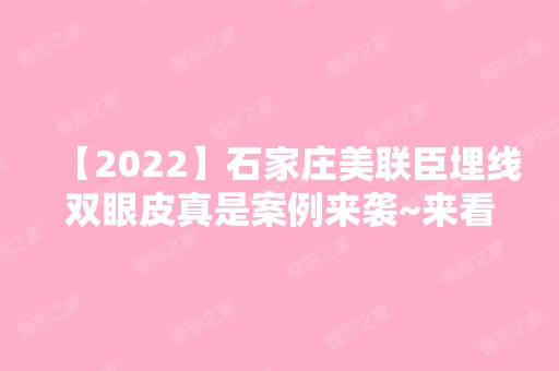 【2024】石家庄美联臣埋线双眼皮真是案例来袭~来看详细内容