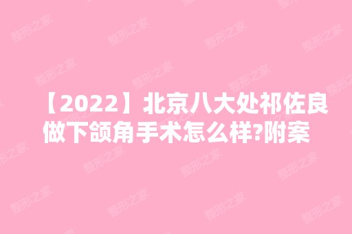 【2024】北京八大处祁佐良做下颌角手术怎么样?附案例及简介