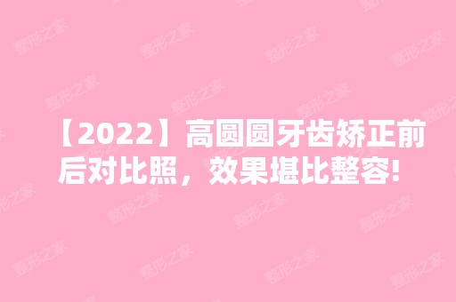 【2024】高圆圆牙齿矫正前后对比照，效果堪比整容!