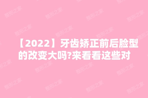 【2024】牙齿矫正前后脸型的改变大吗?来看看这些对比图!