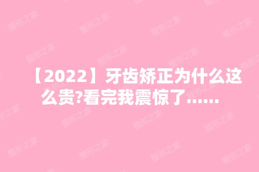 【2024】牙齿矫正为什么这么贵?看完我震惊了......