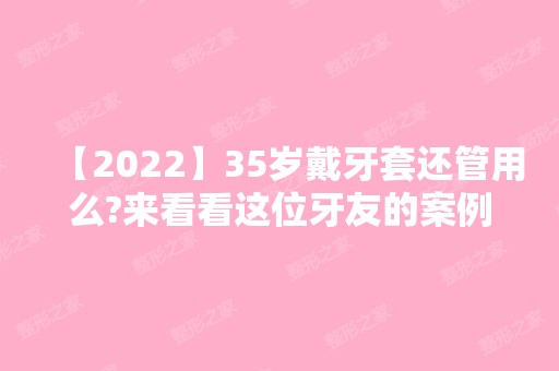 【2024】35岁戴牙套还管用么?来看看这位牙友的案例吧!