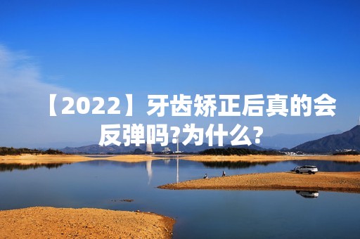 【2024】牙齿矫正后真的会反弹吗?为什么?