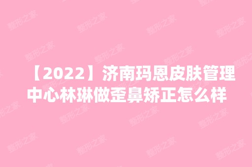 【2024】济南玛恩皮肤管理中心林琳做歪鼻矫正怎么样？附医生简介|歪鼻矫正案例及价