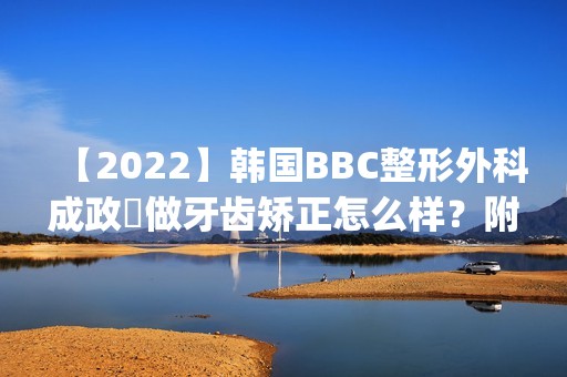 【2024】韩国BBC整形外科成政燁做牙齿矫正怎么样？附医生简介|牙齿矫正案例及价格表